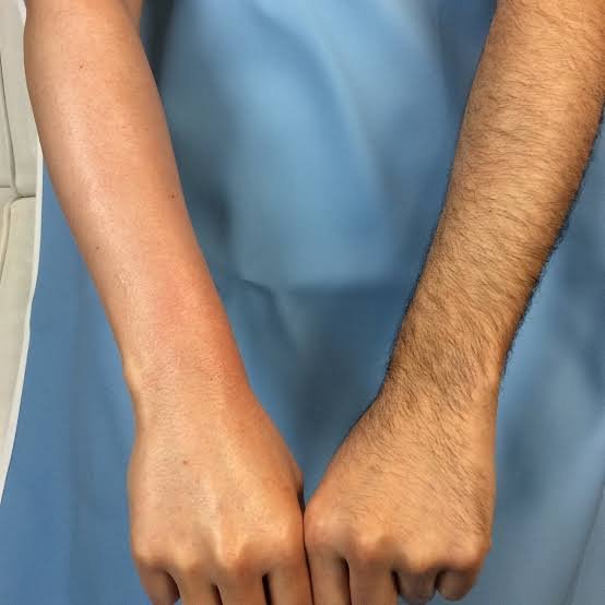 Image #1 from Sandeep Rai